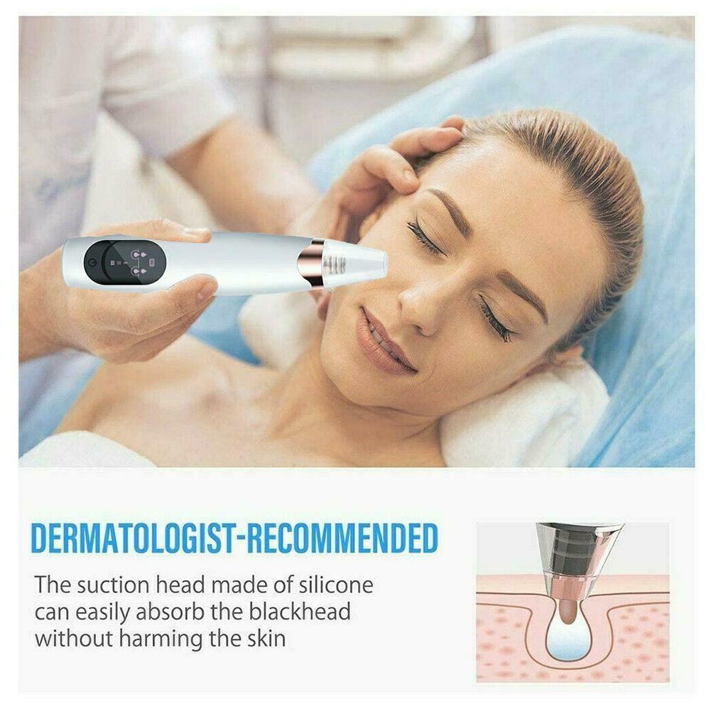 Alat Penyedot Komedo dan Jerawat Komedo Vacum Alat facial