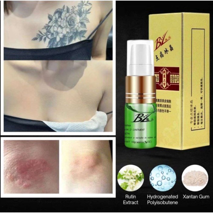 Movaro Tato Remover Penghilang Tato - 1pcs