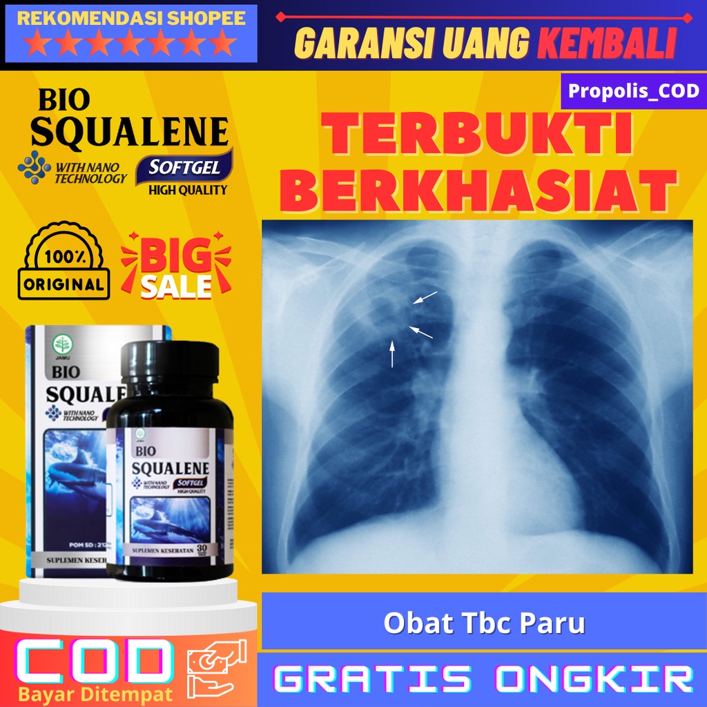 Bio Squalene ORI Obat Tbc Paru - Obat Tbc Anak - Obat Tbc Kelenjar - Obat Tbc Paru Paru - Obat TBC P