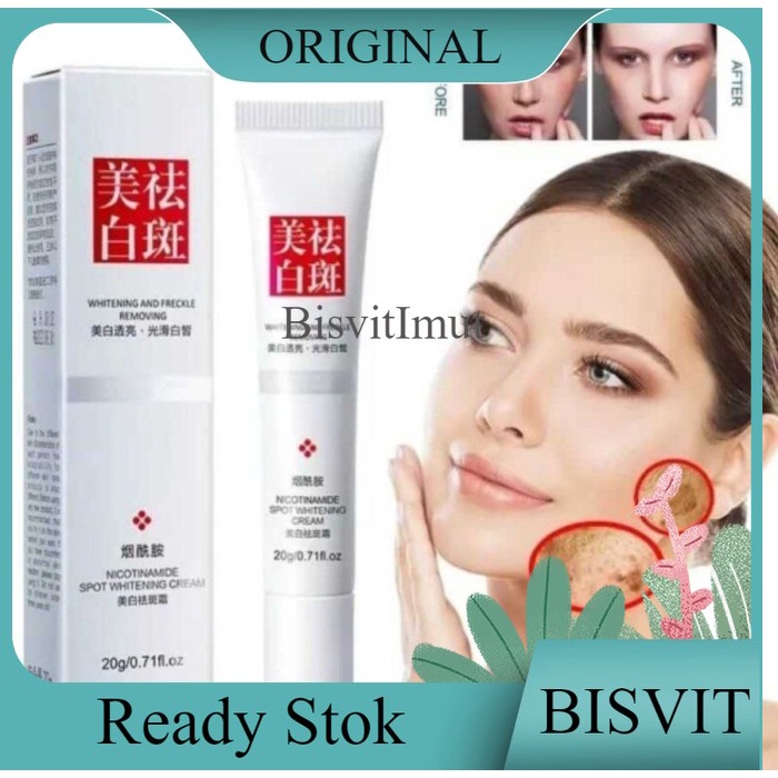 Terbaik Youbuy Whitening And Freckle Removing Krim Flek Melasma Bintik
