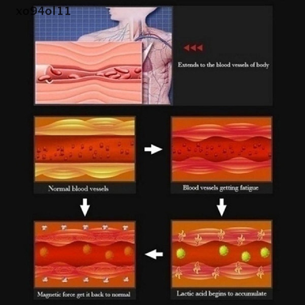 Xo 1pasang Anting Tusuk Pelangsing Anting Kesehatan Penurunan Berat Badan Perhiasan Magnetik OL