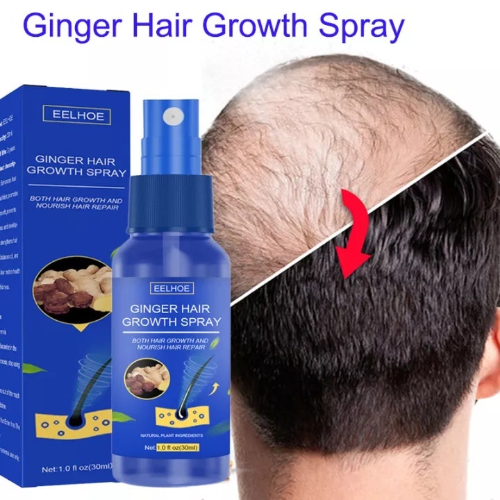 (UMU SUPPLIER) SPRAY PENUMBUH RAMBUT BOTAK, TIPIS DAN RONTOK SUPER CEPAT ORIGINAL AMPUH GINGER HAIR GROWTH EELHOE