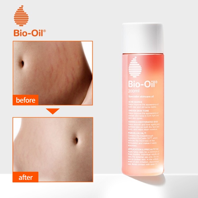 Bio Oil / Penghilang Bekas Luka /Strech Mark /Penghilang Strech Mark / Dry Skin Care 200 ML