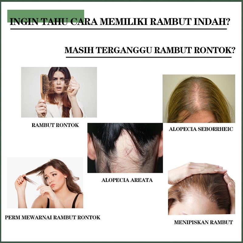 penumbuh rambut Hair growth serum penumbuh rambut botak serum penumbuh rambut 20ml serum rambut rontok Penumbuh Rambut Cepat