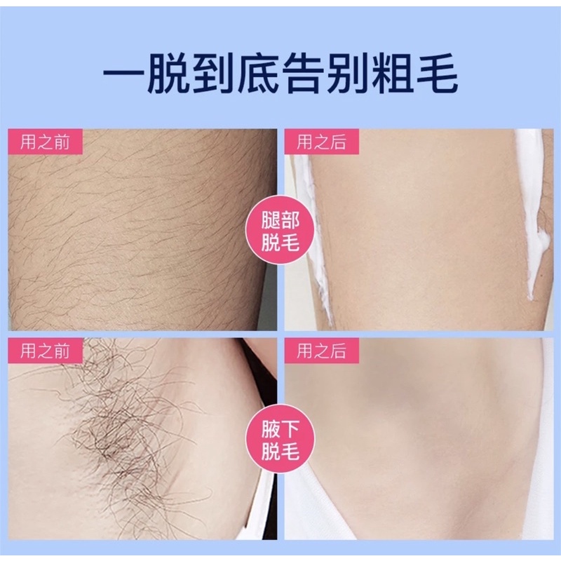 (UMU SUPPLIER) SENANA ADVANCE UNTUK KULIT SENISITIF KOMBINASI HAIR REMOVAL BULU RAMBVUT KUMIS KETIAK