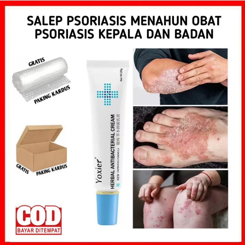 SALEP PSORIASIS MENAHUN OBAT  PSORIASIS KEPALA NEW