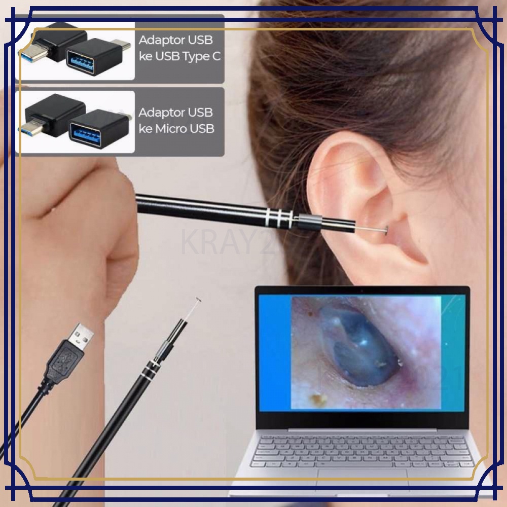 Kamera Endoskopi Pembersih Telinga HD Endoscope USB 2.0 MP - EU-0