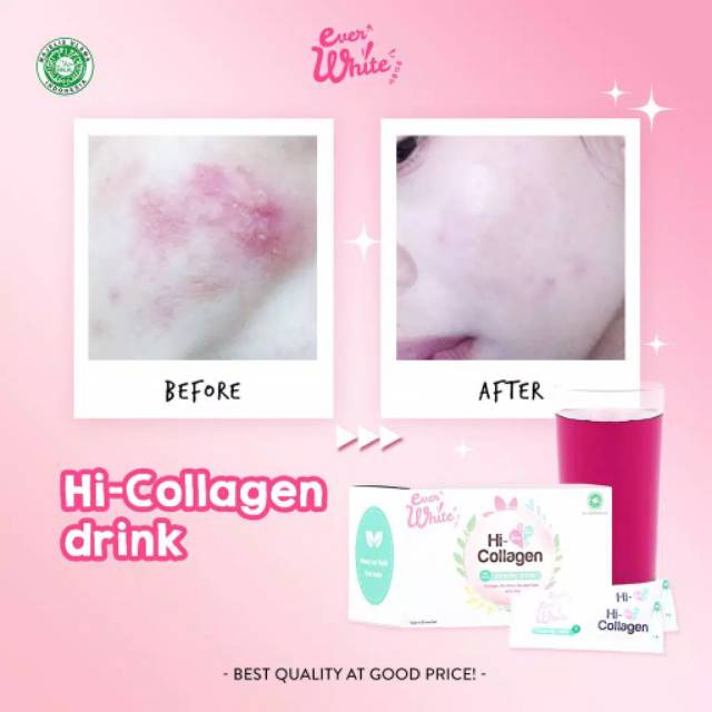 EVER WHITE Hi - Collagen Drink [ Ecer ] 12gr | EVERWHITE