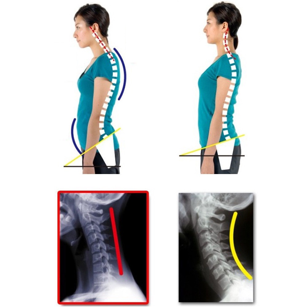 Tali Korektor Postur Punggung Back Body Harness - BBJ-17