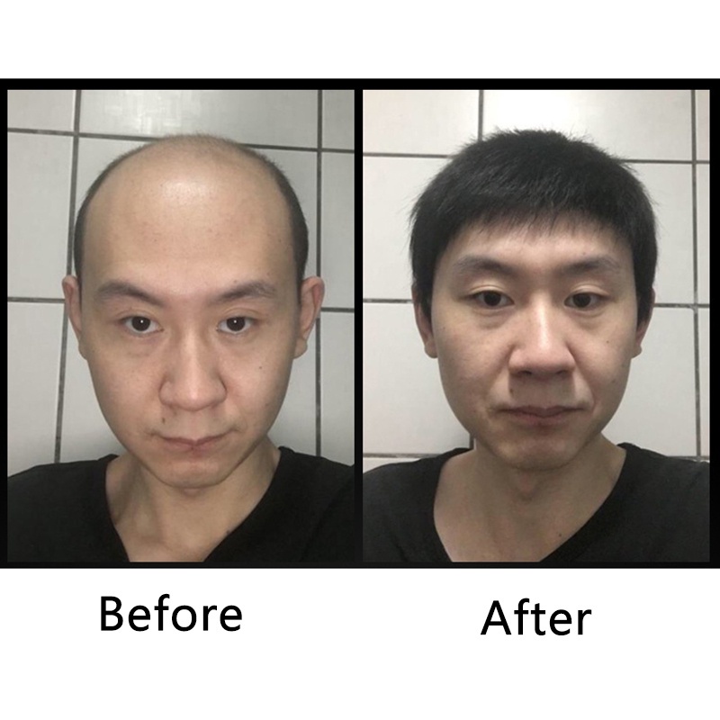 【Pengiriman lokal】 rambut palsu pria Tersedia Wig untuk Pendek Pria Wig Rambut Bagian Kepala Penggan