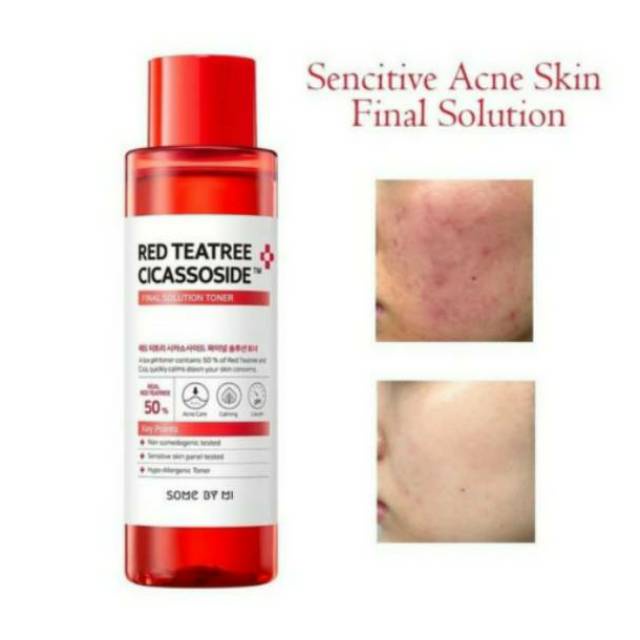 Original- SOMEBYMI Red Tea tree  Cicassoside Final Solution Toner 150ml - Some by mi red tea trea to