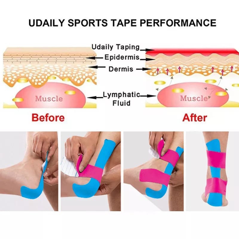 (COD) KINESIO TAPE 5M - Kinesiologi Tape Taping Pita Plester Otot Gym Fitness