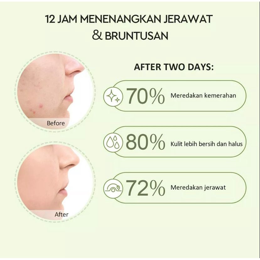 Glad2Glow Real Mugwort Clay Mask Salicylic Acid Anti Pores&amp;Acne Jerawat Komedo Cleansing Masker 30g BPOM