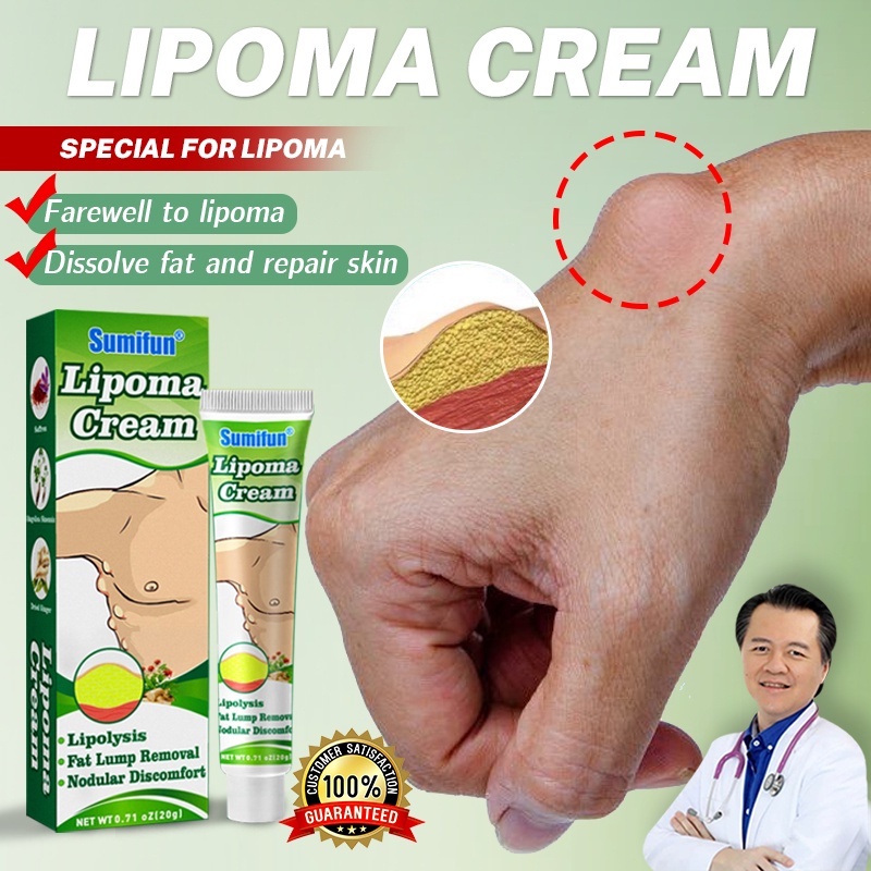 Sumifun Obat Benjolan Lipoma Salep Lipoma Herbal/Fibroid/Benjolan Subkutan/Leher Benjolan/Punggung Pundak Benjolan/Kista Ganglion Benjolan/Kelenjar Tiroid Limfoma Limpoma Kelenjar-20g Lipoma Remover Treatment Ointment