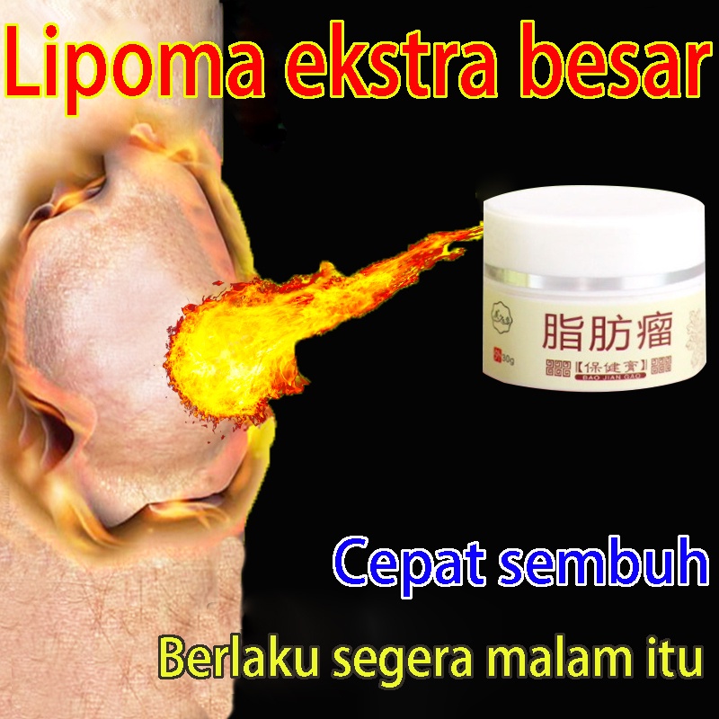 BPOM Obat Benjolan Lipoma Obat herbal Cina Krim lipoma 30g Perawatan punggung/leher/paha Kanker Tumo