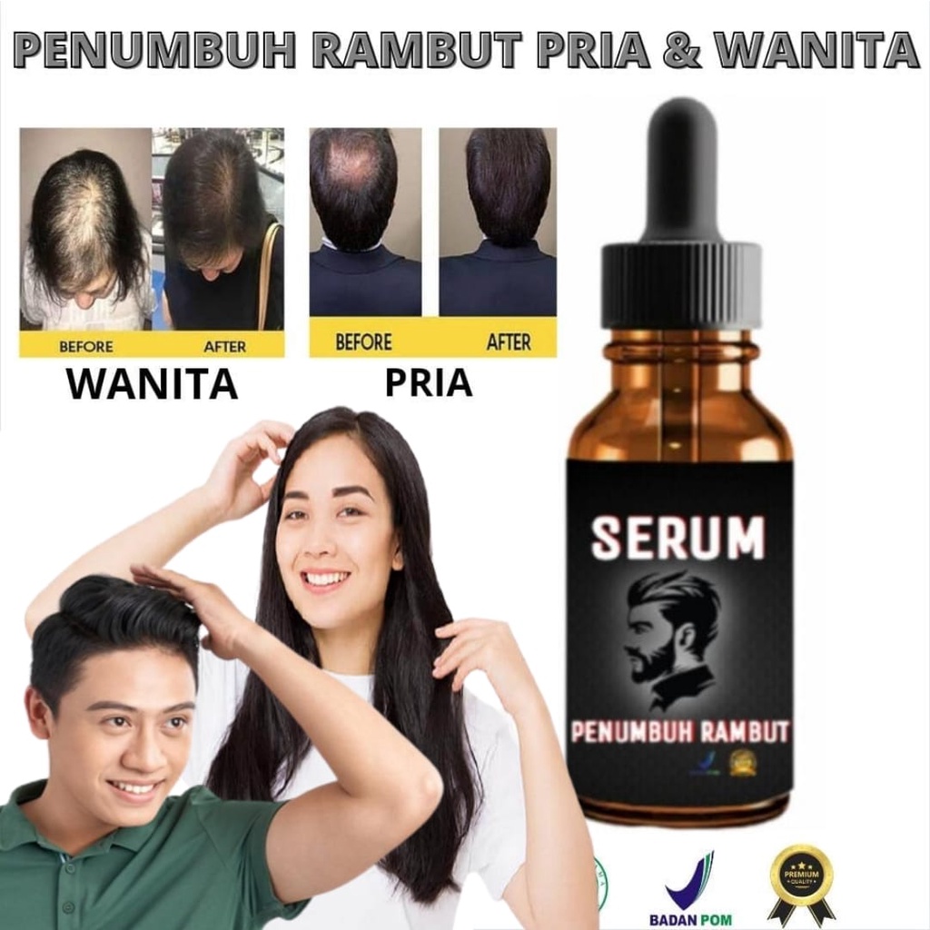 [VIRAL] DISKON 89% Penumbuh Rambut,Penumbuh rambut botak pria,Serum penumbuh rambut / Penumbuh rambu