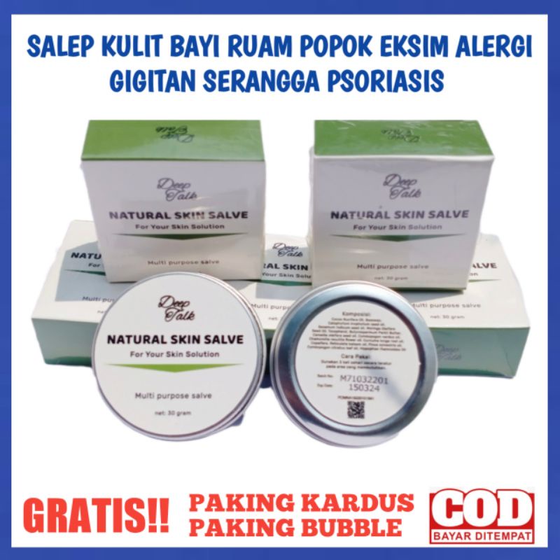 SALEP RUAM POPOK ALERGI EKSIM GIGITAN SERANGGA SALEP BAYI CREAM BABY SALEP GATAL BAYI XOD