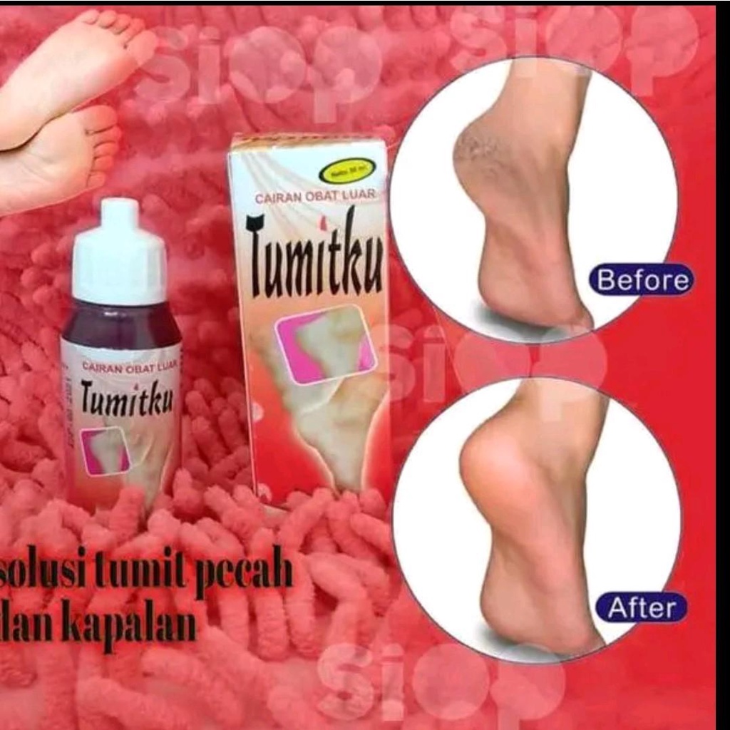 TUMITKU SOLUSI TUMIT PECAH PECAH