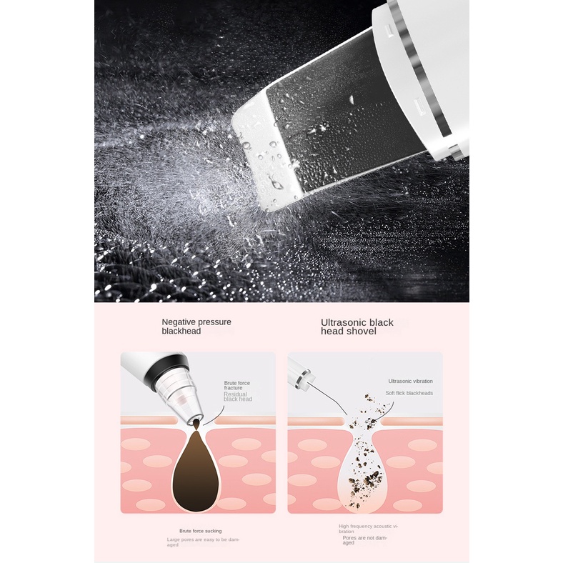 Electric Facial Skin Scrubber Gentle Ultrasonic Penghilang Komedo Alat Perawatan Wajah