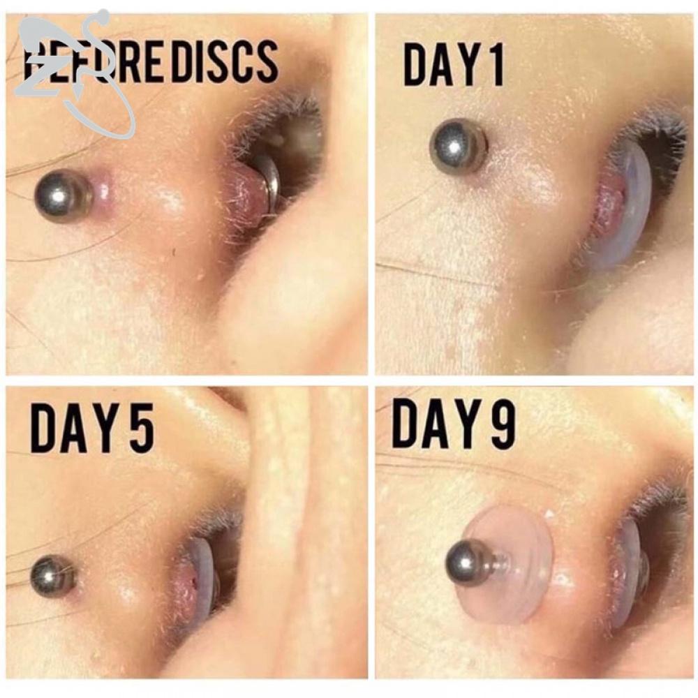6-200pcs/lot Silikon Nopull Piercing Healing Discs Flexible Anti Hiperplasia Untuk Belakang Anting Lembut Anti Invaginatio