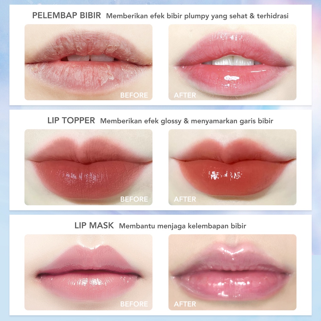 𝐑𝐀𝐃𝐘𝐒𝐀 - YOU Colorland Icy Glow Lip Serum | Serum Bibir | Vitamin E | Lip Balm | Pelembab Gloss Untuk Bibir Hitam | Lip Care
