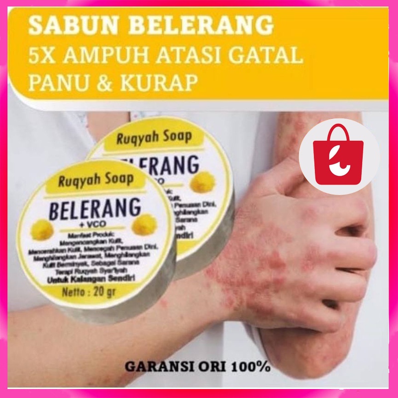 [100% Asli] Sabun gatal kulit paling ampuh Sabun belerang untuk gatal asli Sabun muka belerang buat gatal Sabun belerang asli original Sabun Sulfur