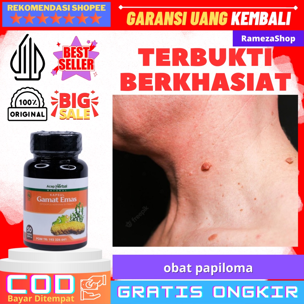 obat papiloma  obat papiloma leher  obat penghilang papiloma Obat Papiloma Di Leher Penghilang Kutil Papiloma Di Wajah Kutil Di Leher Kapsul Gamat  Emas