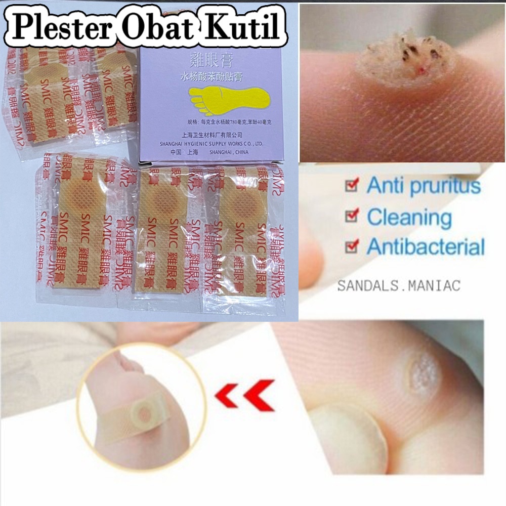 Plester Obat Kutil &amp; Mata Ikan ( 1 BOX 6pcs ) Case Koyo Tempelan Obat Mata Ikan / Penutup Kutil / Koyo Kutil / Penutup Mata Ikan Jin Yan Gao / Obat Mata Ikan Kapalan Caplak / Corn Caps Obat Kutil / Plester Kutil Ampuh