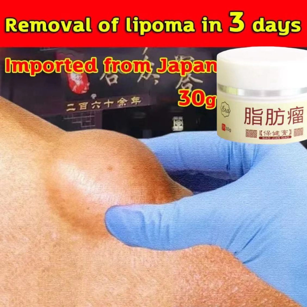 Obat Benjolan Lipoma Obat herbal Cina Krim lipoma 30g Perawatan punggung/leher/paha Kanker Tumor Kel