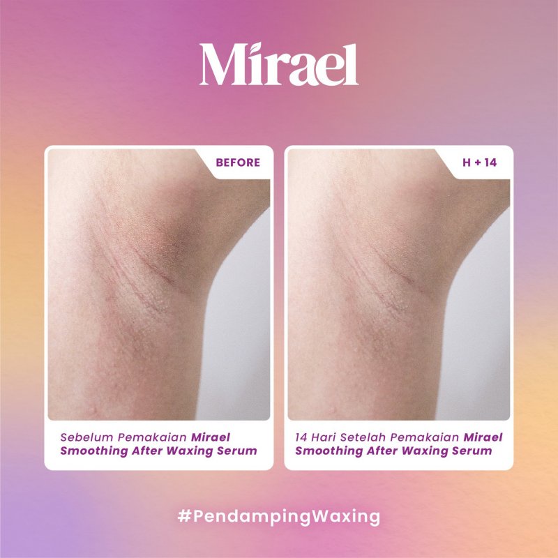 Mirael  After Waxing Serum (Brightening/Smoothing)(10ml/78ml)