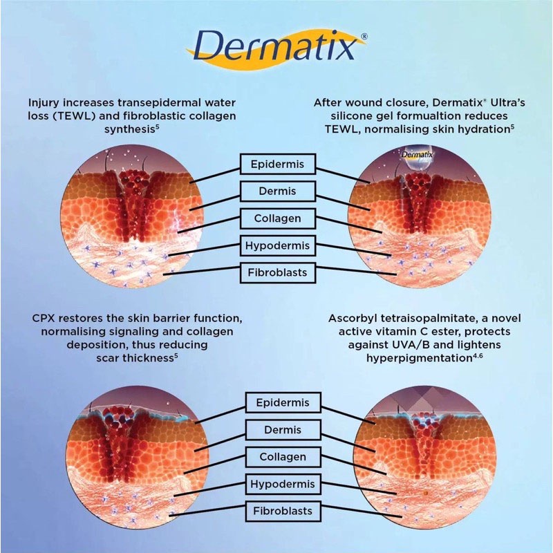 Dermatik Ultra / Dermatic / Dermatix Ultra 15Gr Cream Krim Penghilang Bekas Luka 15 gr