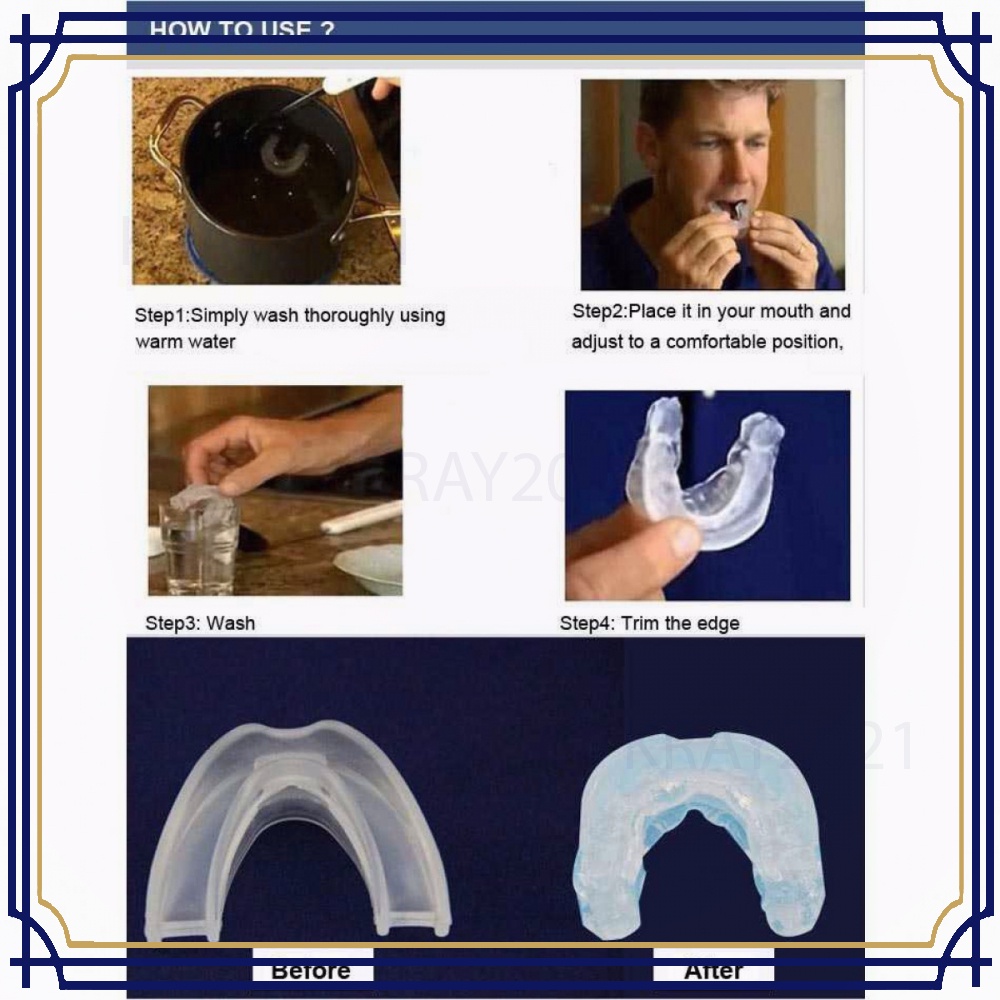 Stop Snoring Solution Mouthpiece / Alat Bantu Ngorok HT830