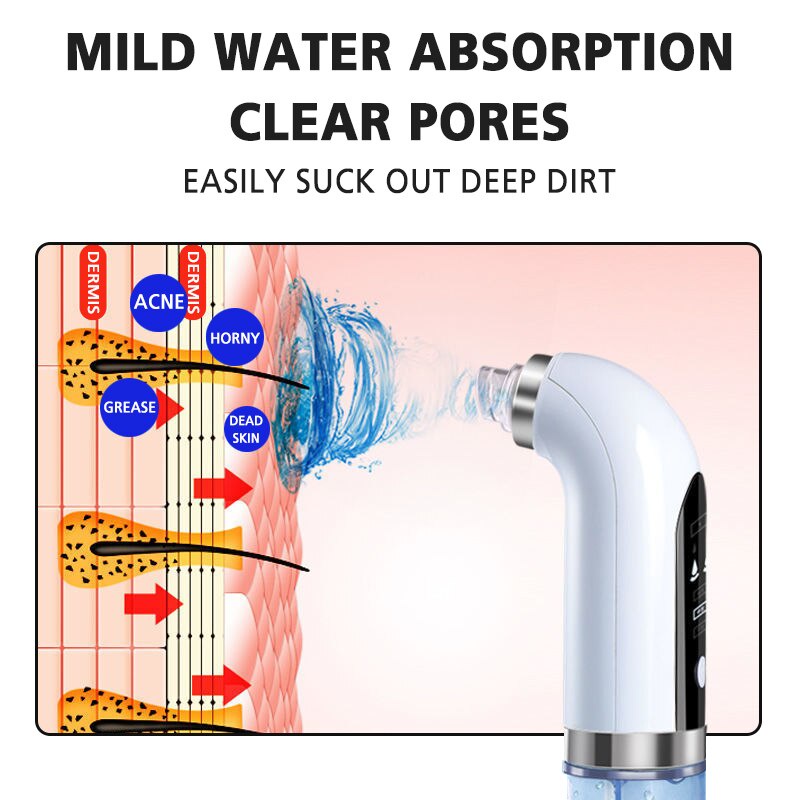 Penghilang Komedo Elektrik Vacum Perawatan Kulit Wajah Whitehead Acne Vacum Sedot Pori Clean Machine Alat Kecantikan Pori