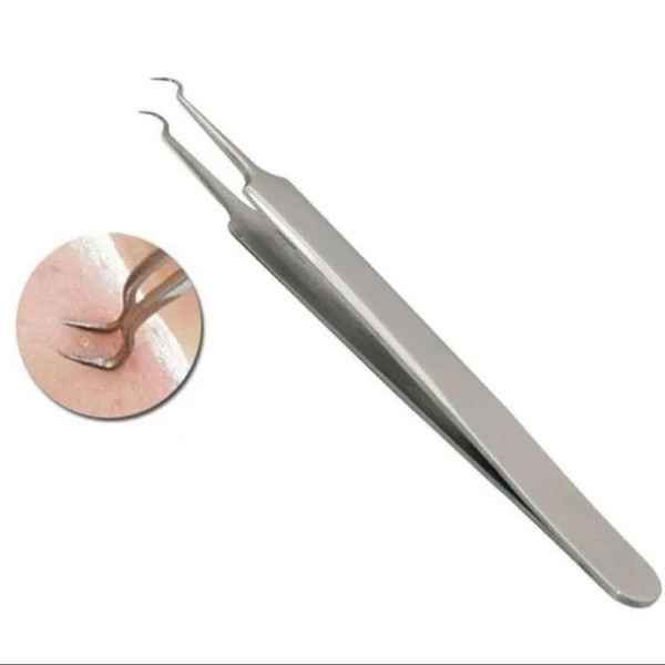 Pinset Jepit Komedo Stainless Steel Blackhead Tweezer Alat Capit Untuk Menghilangkan Komedo Penjepit Komedo