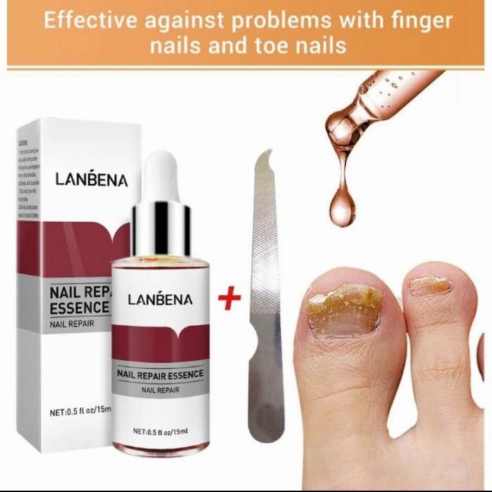 LANBENA Nail Repair Essence /Serum kuku jamur /vitamin kuku