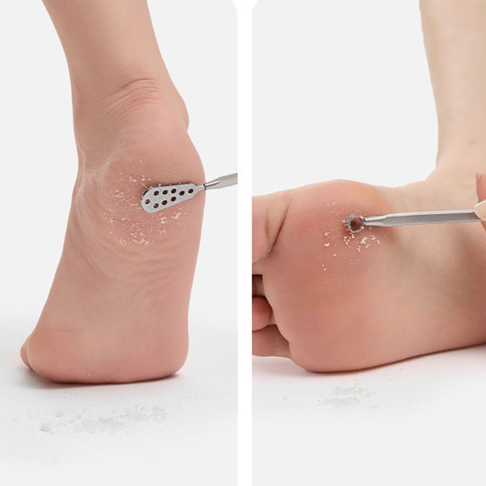 Needway Toe Nail Scraper Profesional Hitam Putih Alat Perawatan Kaki Exfoliating Toe Nail Shaver Callus Rasp File Alat Cukur Kutikula