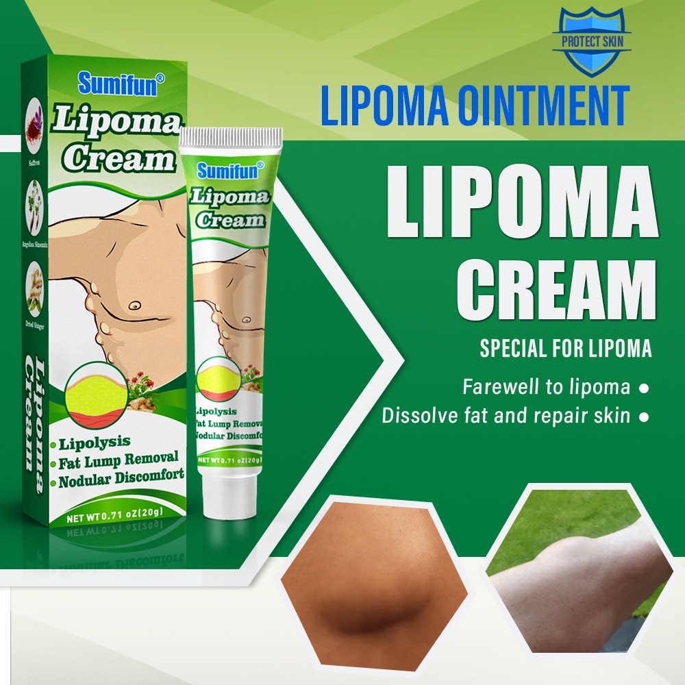 Sumifun Obat Benjolan Lipoma Salep Lipoma Herbal/Fibroid/Benjolan Subkutan/Leher Benjolan/Punggung Pundak Benjolan/Kista Ganglion Benjolan/Kelenjar Tiroid Limfoma Limpoma Kelenjar-20g Lipoma Remover Treatment Ointment