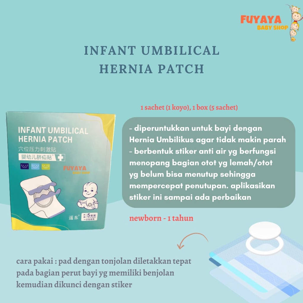 KOYO HERBAL HERNIA ANAK / PUSAR BODONG / Infant Umbilical HERNIA Patch / Koyo Herbal Bayi Anak / Stiker Hernia Bayi / Manjur