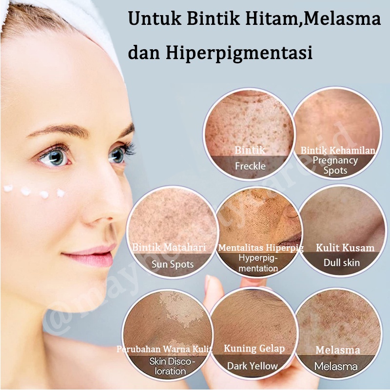 Krim Pemutih Bintik Efektif 7X Niacinamide Menghilangkan Melasma 100% ORI Salep Flek Hitam Melasma Ampuh Salep Flek Bandel Whitening Night Cream Penghilang Flek Membandel Menghilangkan Bintik Melasma Untuk Menghilangkan Chloasma, Flek Hitam, Jerawat