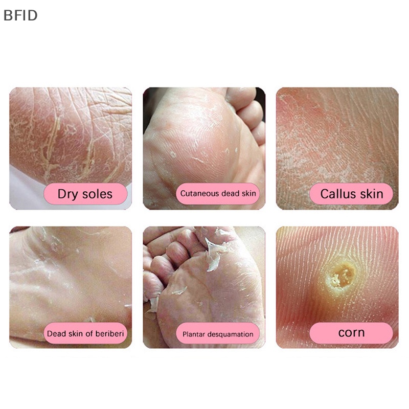 [BFID] Kikir Kaki Pedicure Stainless Steel Kulit Mati Keras Callus Remover Foot Grinder [ID]