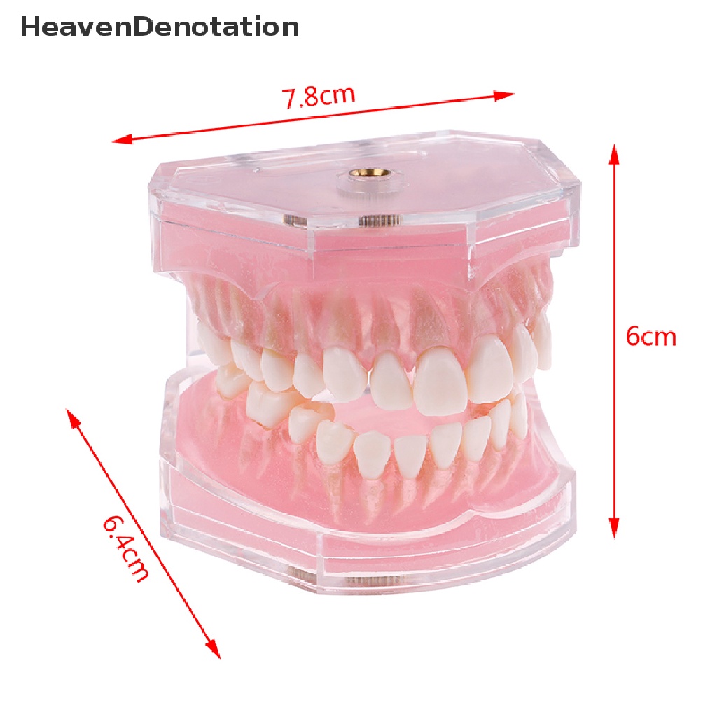 [HeavenDenotation] Plastik typodont orthodontic model Standar4004Dengan 28gigi Lepas HDV