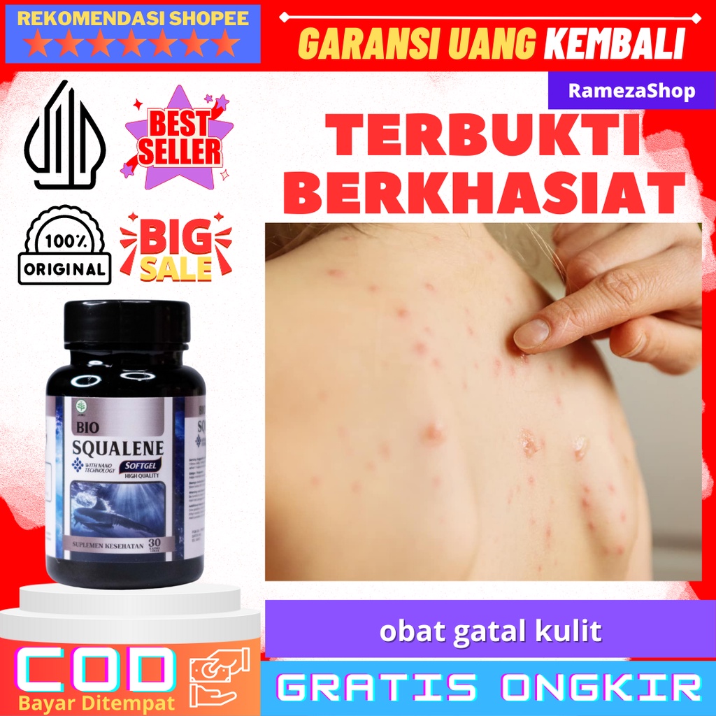 obat gatal kulit  Obat Gatal Seluruh Badan, Obat Penghilang Gatal Kulit, Obat Kulit Eksim, Obat Gata