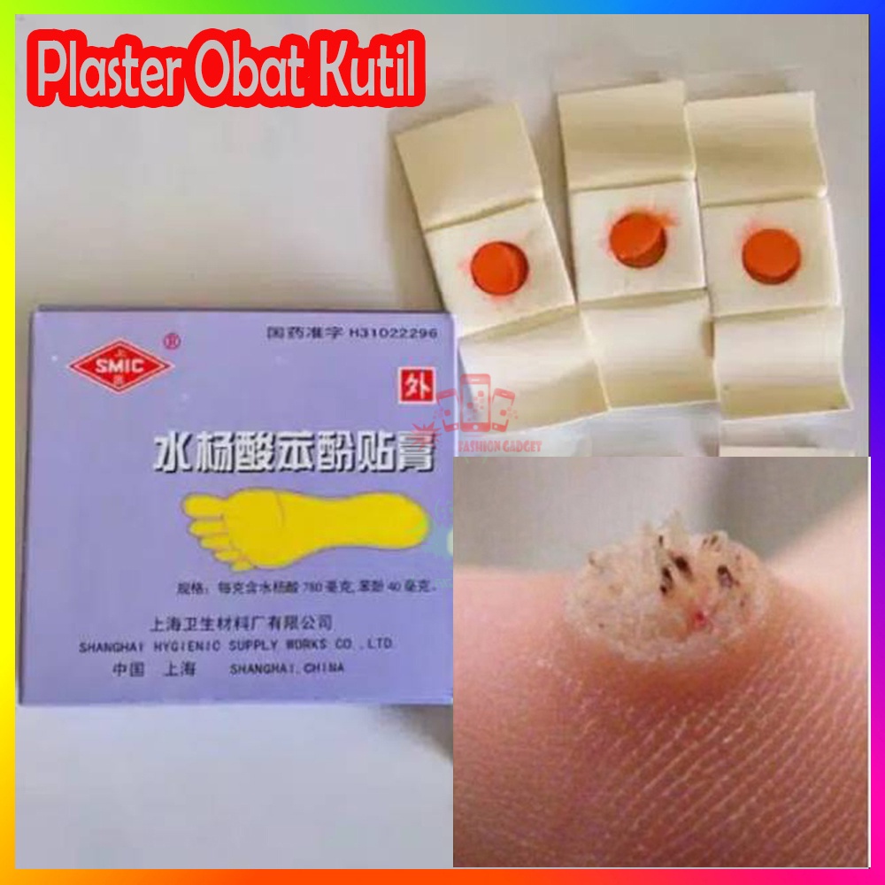 Plester Obat Kutil &amp; Mata Ikan ( 1 BOX 6pcs ) Case Koyo Tempelan Obat Mata Ikan / Penutup Kutil / Koyo Kutil / Penutup Mata Ikan Jin Yan Gao / Obat Mata Ikan Kapalan Caplak / Corn Caps Obat Kutil / Plester Kutil Ampuh