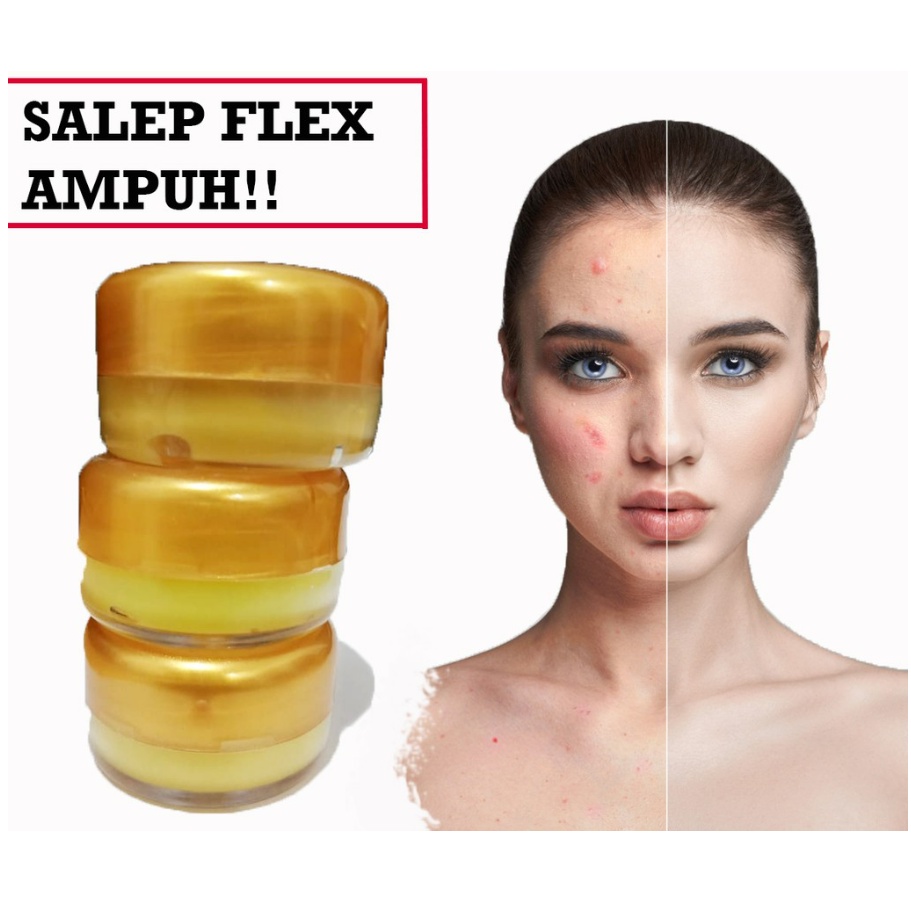 Salep Flek Hitam Melasma Ampuh Salep Wajah Menghilangkan Flex Hitam Dan Jerawat