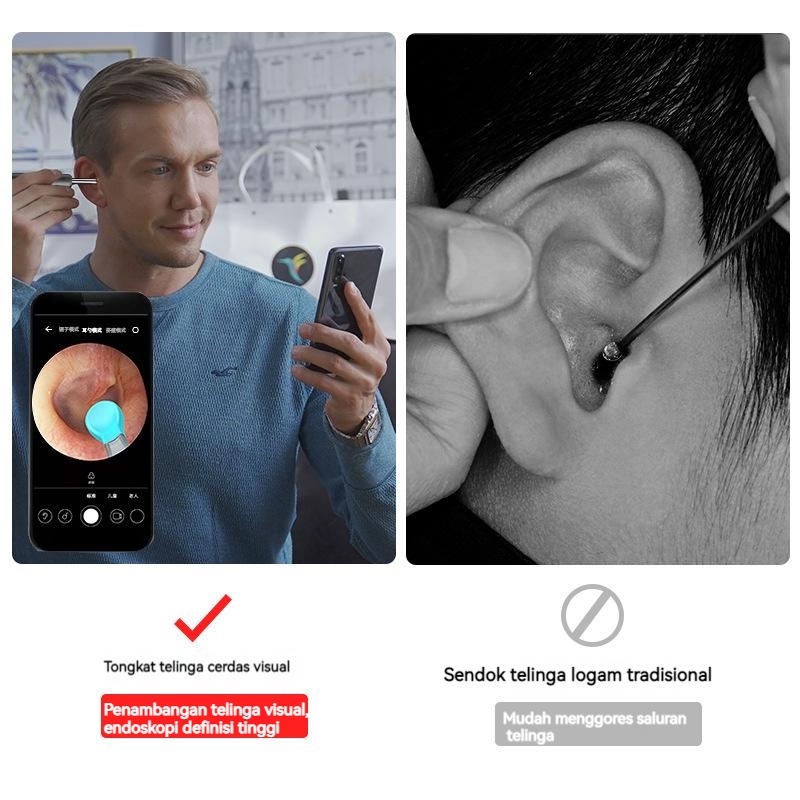 【COD】LED Smart Visual Ear Stick/Ear Cleaning Endoscope Korek Kuping/Korek Kuping Kamera LED Smart Visual Ear Stick HD