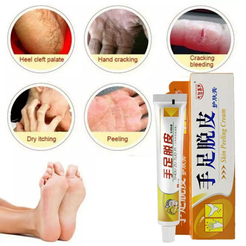 VERSI ORANGE SALEP TUMIT KAKI PECAH-PECAH TANGAN KAPALAN ( SKIN PEELING CREAM )