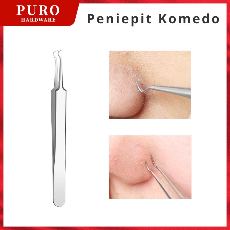 Alat Capit Untuk Menghilangkan Komedo / Pinset Jepit Komedo Stainless Steel Blackhead Tweezer / Penjepit Komedo