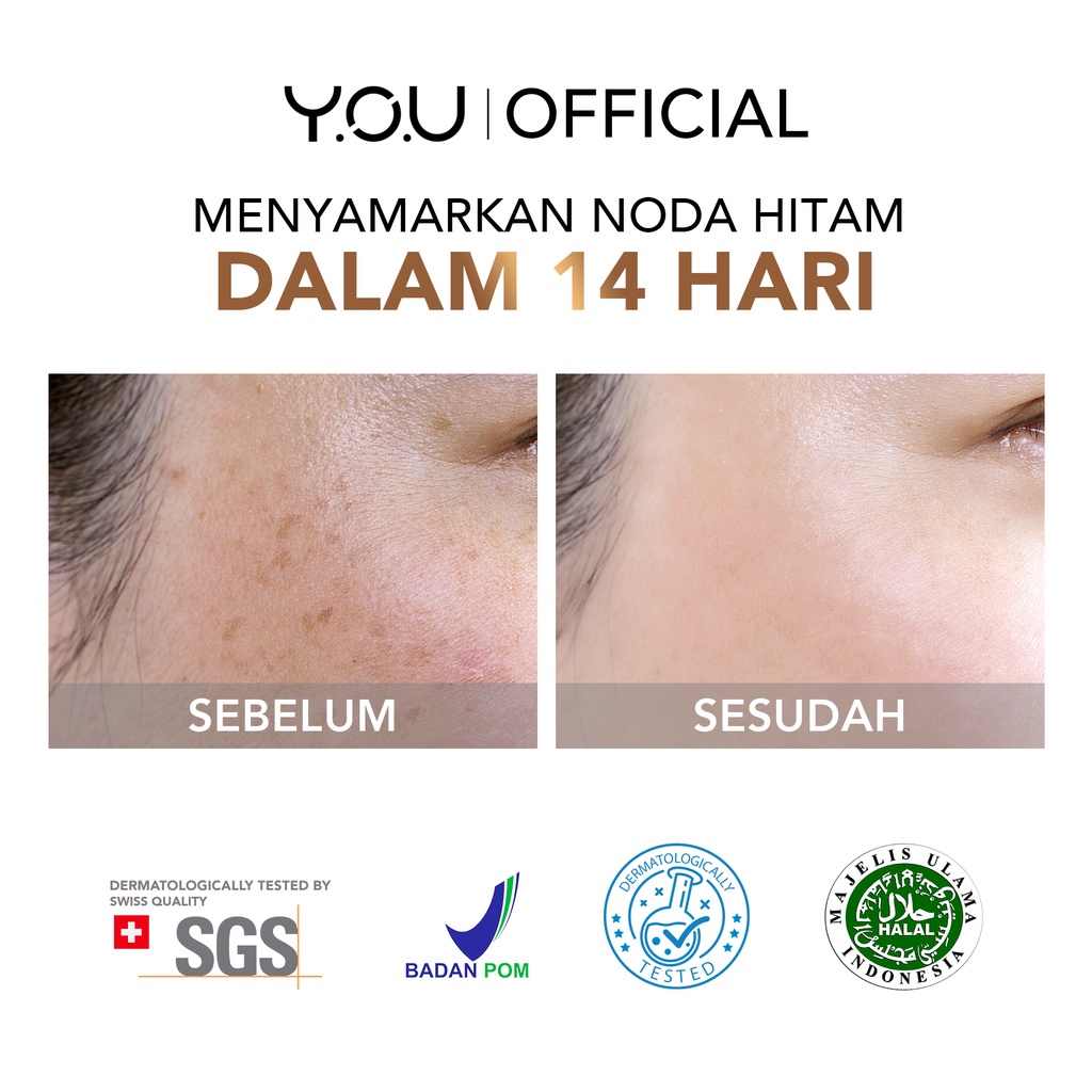 YOU 8× SymWhite 377 Radiance Up! Brightening Serum with Niacinamide Vitamin C | Atasi Bekas Jerawat VITAMINKU