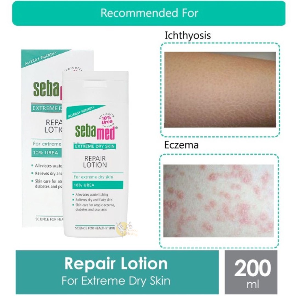 Sebamed Extreme Dry Skin Repair Lotion 200ml