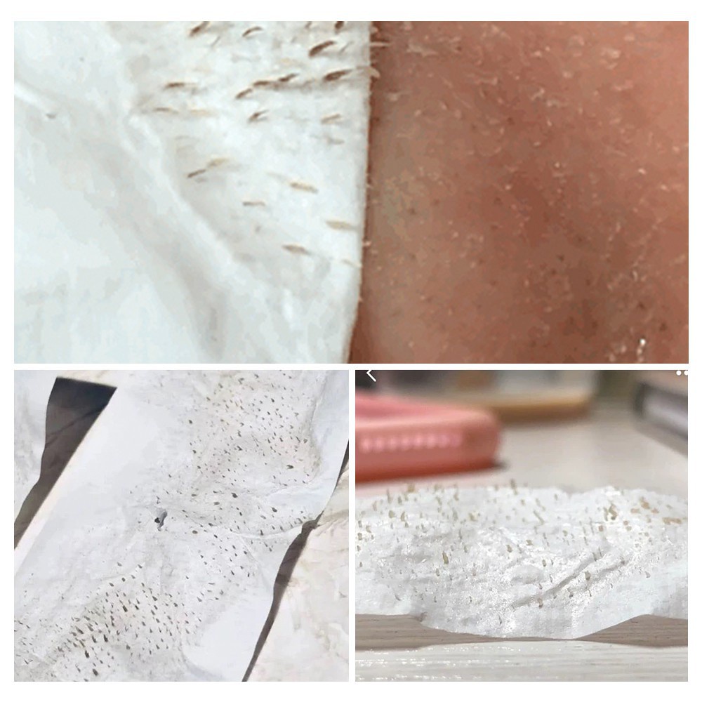 BREYLEE Blackhead Set - Pembersih Komedo &amp; Pengecil Pori-Pori (2pcs)